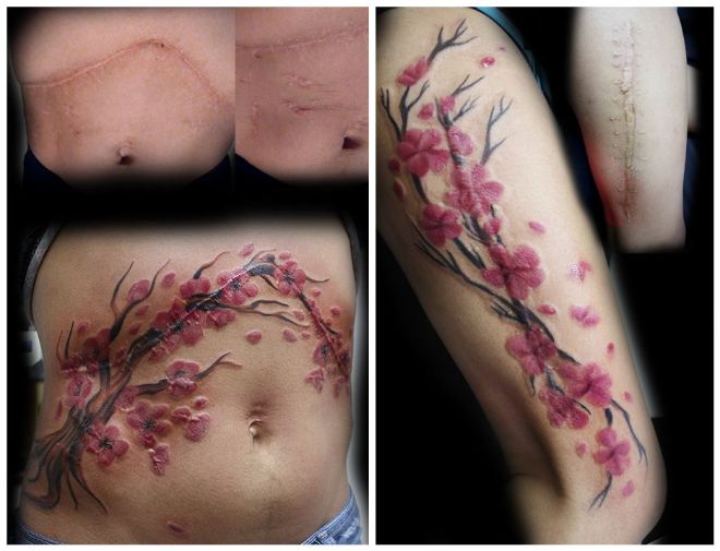 scars turned into tattoos 3