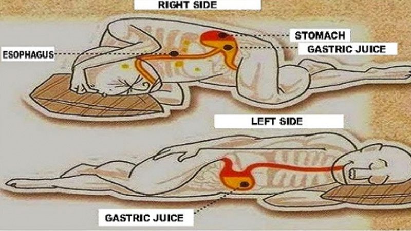right side sleeping position 3