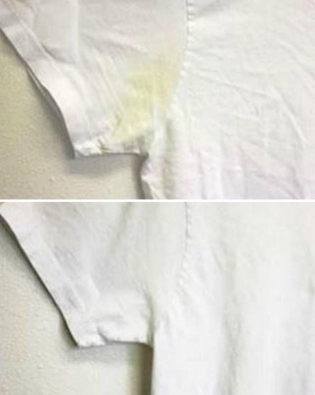 removing stains from fabric