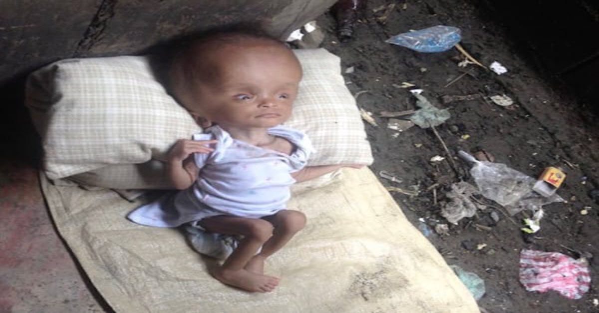 She Found This Sick Baby Girl In A Pile Of Trash. What She ...