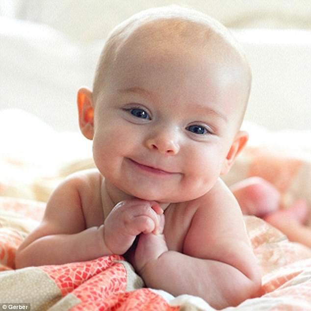 Gerber Baby Down Syndrome 